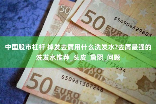 中国股市杠杆 掉发去屑用什么洗发水?去屑最强的洗发水推荐_头皮_黛熙_问题
